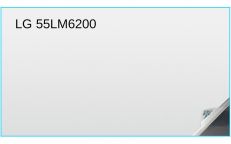 LG 55LM6200 55-inch TV Screen Protector
